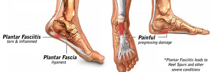 Schmerzen, Fussbrennen,Fussballenschmerzen,Achillessehnenschmerzen,Schienbeinschmerzen,Schmerzende Beine,Hallux,Diabetes,Plattfuss Senkfuss,zu kalte zu heisse Füsse,Spitzfuss Klumpfuss, Neuropathie,Hohes Fussgewölbe,Metatarsalia Mittelfussknochenprobleme,schlechte Blutzirkulation,Morton-Neurom Morton-Neuralgie,Fasciitis plantaris Fersensporn,Happy Feet Einlagesohlen mit Barefoot Technologie
